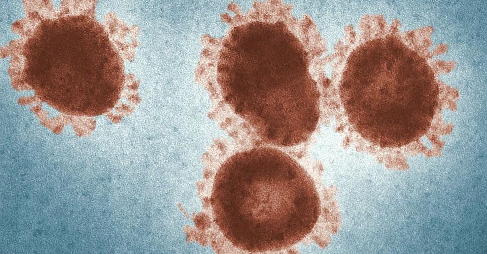 This Microbe Breaks All the Rules