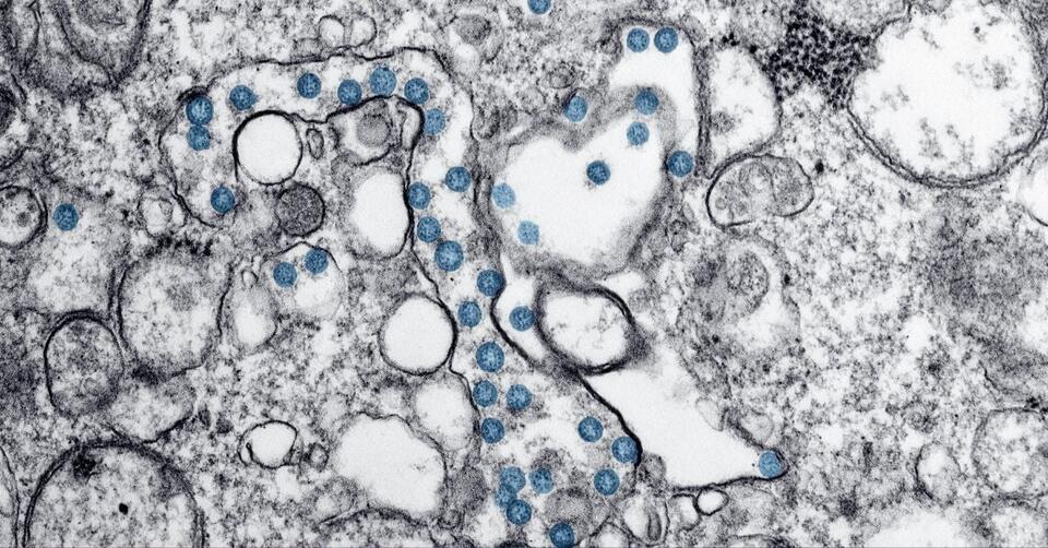 This Microbe Breaks All the Rules