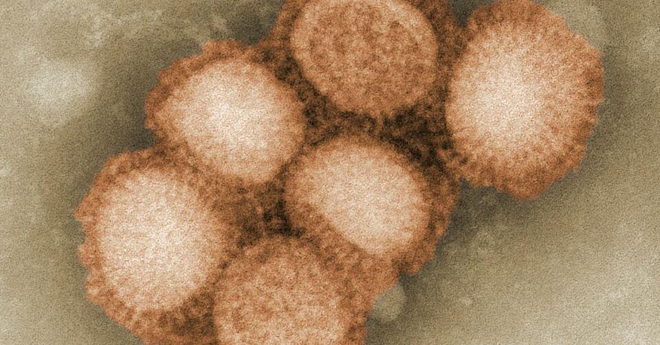This Microbe Breaks All the Rules