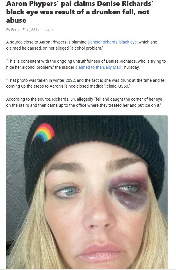 Denise’s Black Eye: Accident or Abuse? 👀
