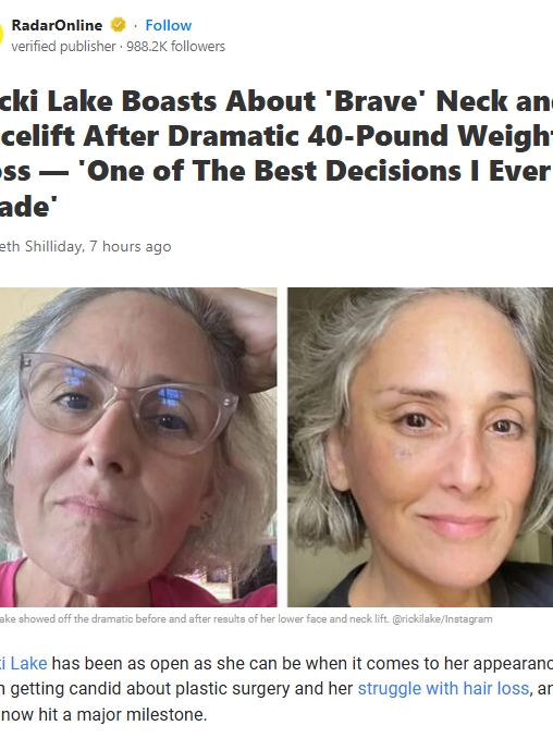 Ricki Lake’s Facelift Glow-Up Reveal