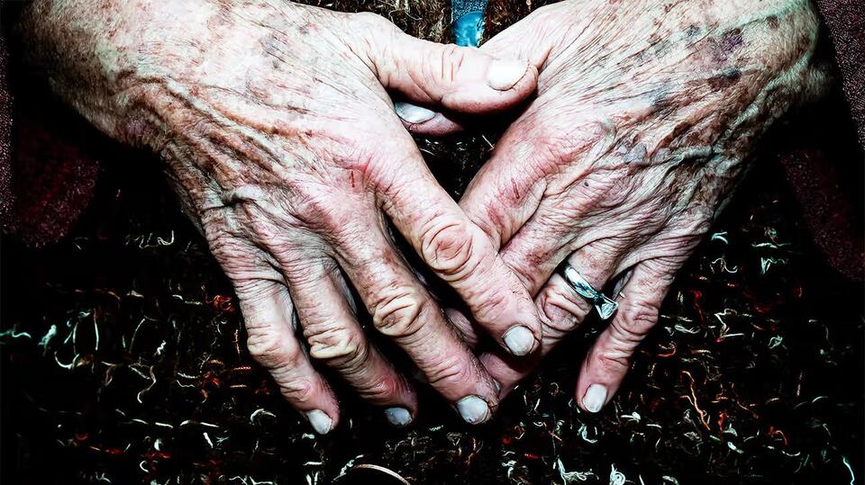 Parkinson’s Could Be Detected by a Skin Swab?!