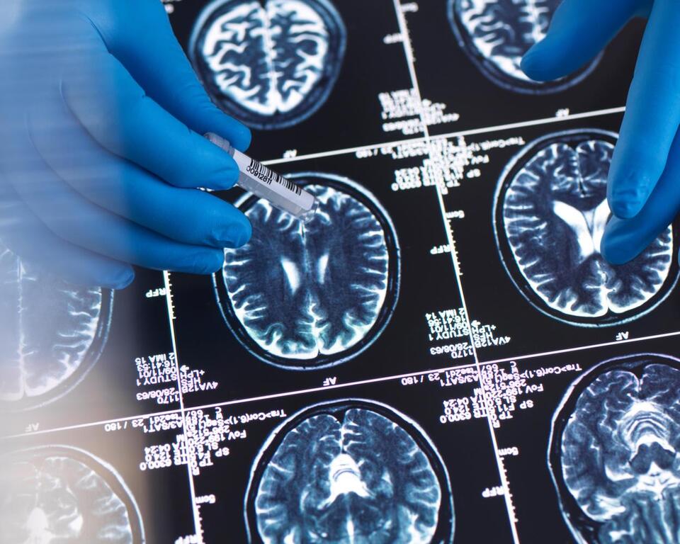 Optimists’ Brains Are Literally in Sync