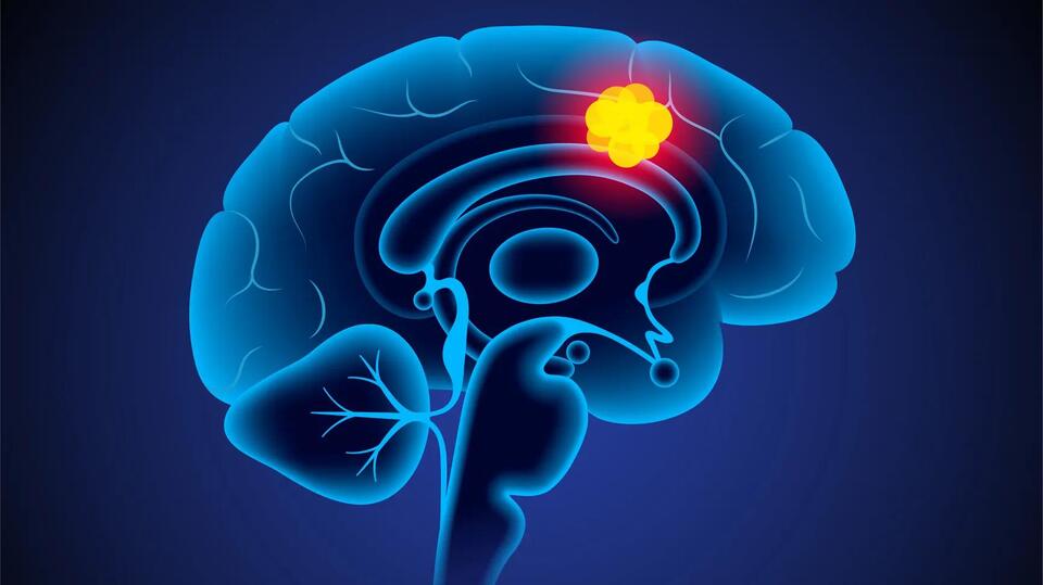 Miracle Drug Zaps Deadly Brain Tumor