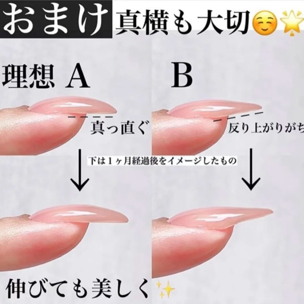 A or B—which one’s your pick? 