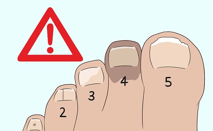 WTF with my black toe🦶???