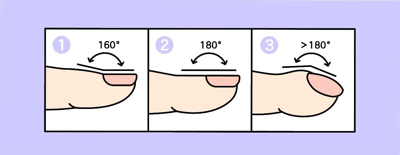 Do you have healthy, straight fingers?  