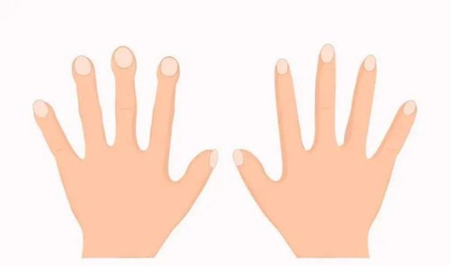 Fingers look like this? watch out! Could be life-threatening!