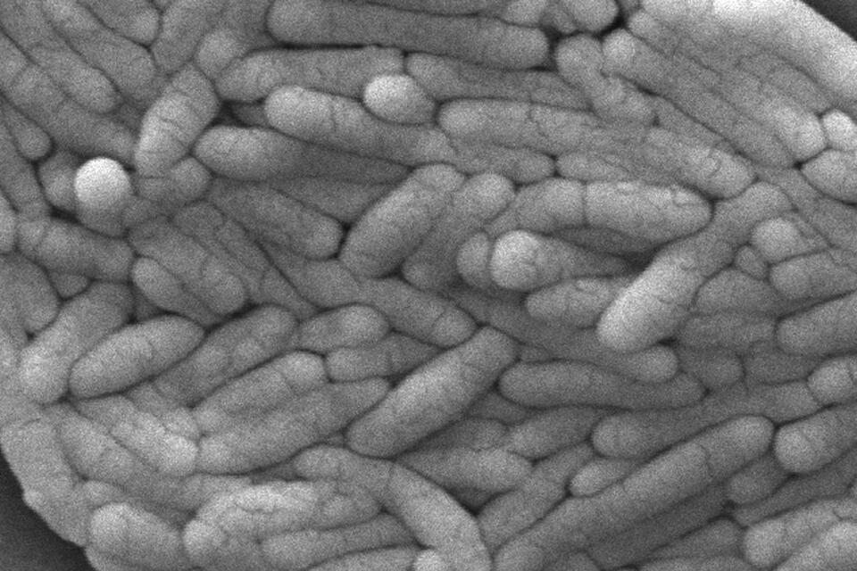 Your Gut’s Secret Superpower Revealed