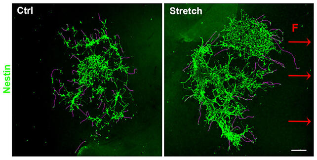 Tiny Magnets Could Rewire Brains!