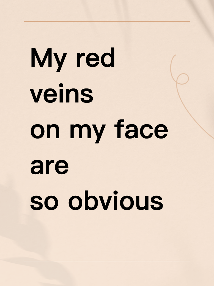 My red veins on my face are so obvious, it’s embarrassing.