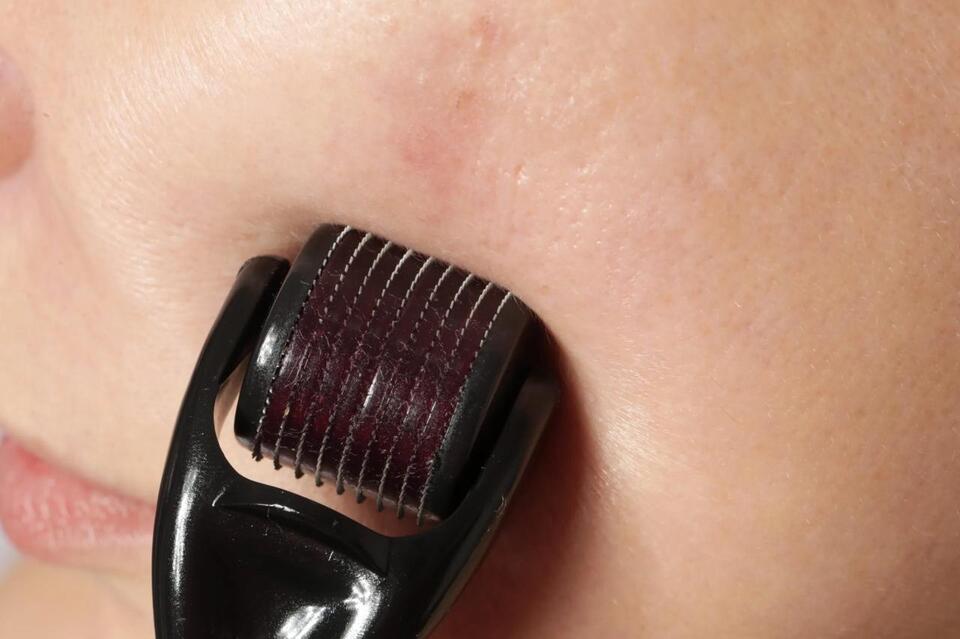 3 Anti-Aging Treatments Docs Say to Skip