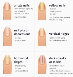 Quick—check your nails! The ultimate nail-problem cheat sheet!