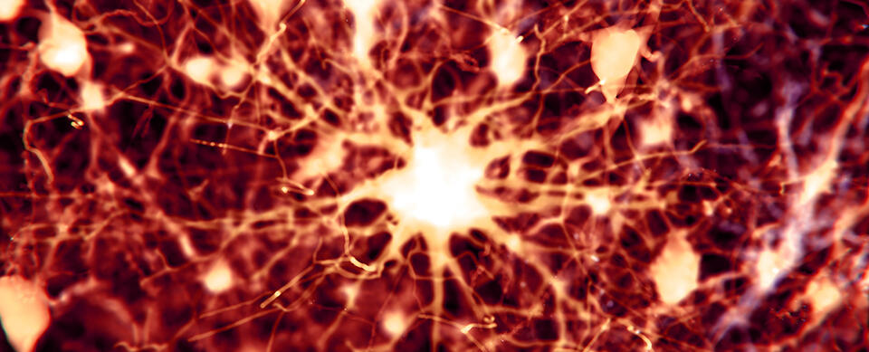 Cancer Drugs Show Promise for Alzheimer’s