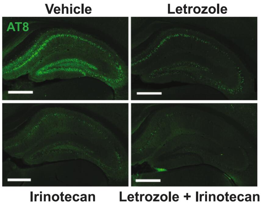 Cancer Drugs Show Promise for Alzheimer’s