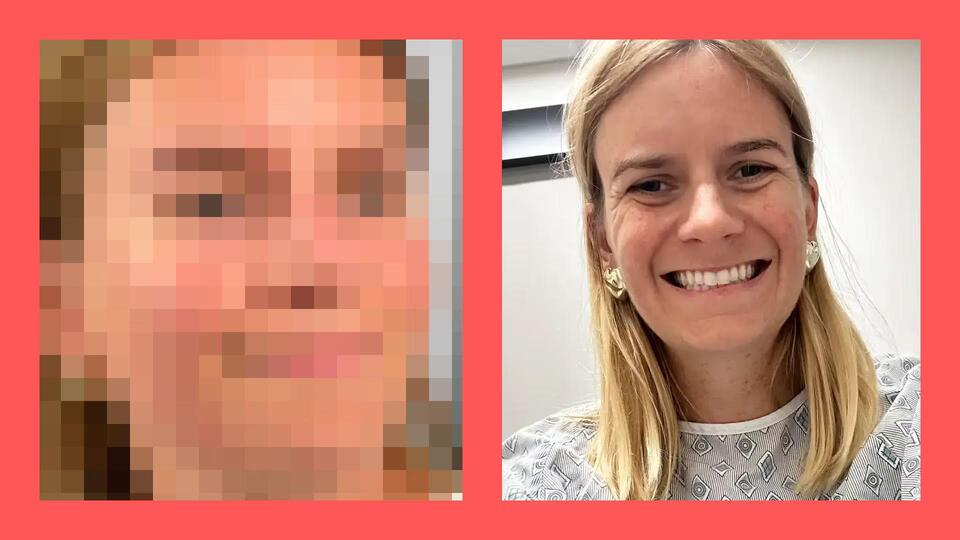 Texas woman’s spider bite nightmare