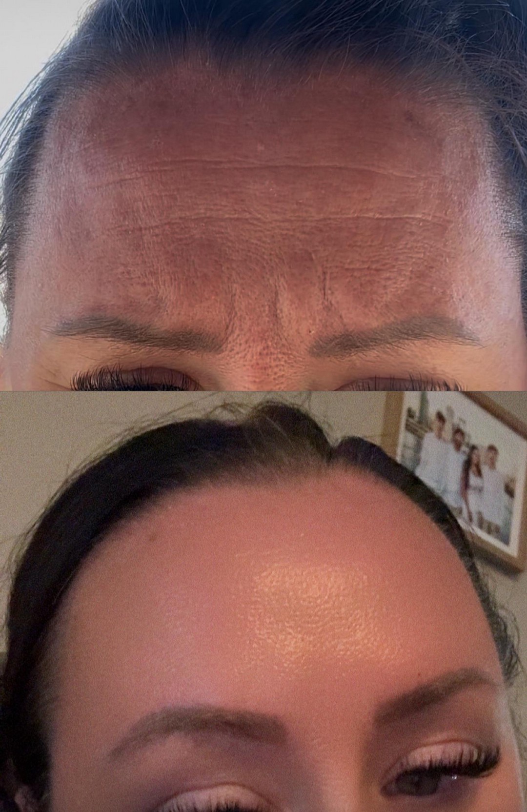 I've always said I’d never get botox until I saw THIS
