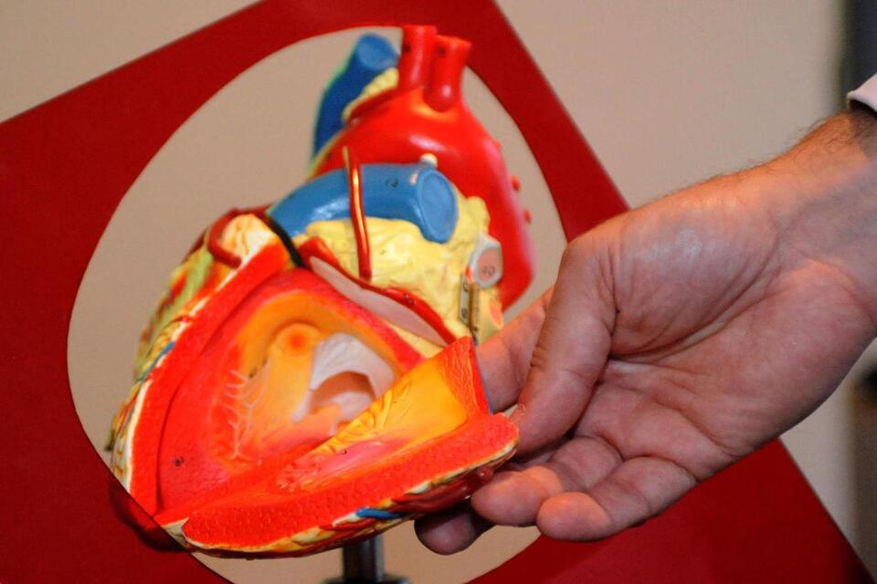 Would You Zap Your Nerves for Better Fitness?