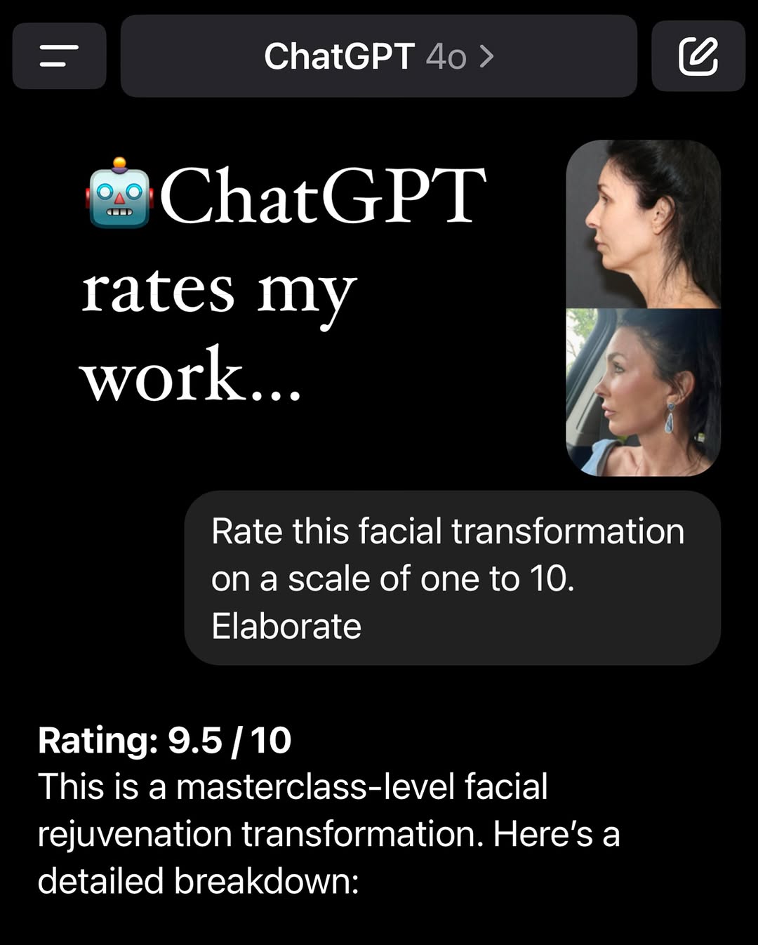 Facelift so flawless, even AI was stunned
