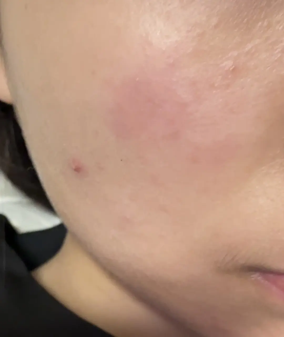 Is this like… barrier damage or am I being dramatic