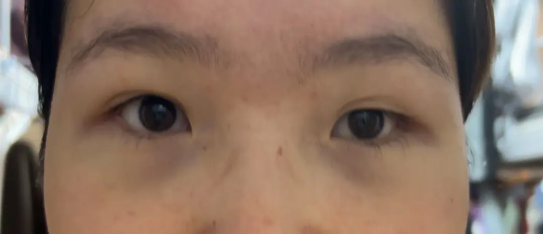Graduation photos are coming and my eyes don’t match 😭
