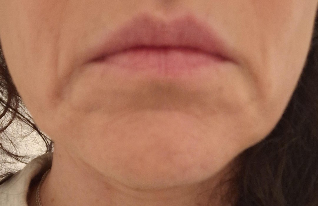 Women’s faces hit a landslide at 45