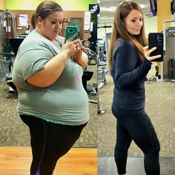 She Lost 310lbs—But Now Faces a New Battle