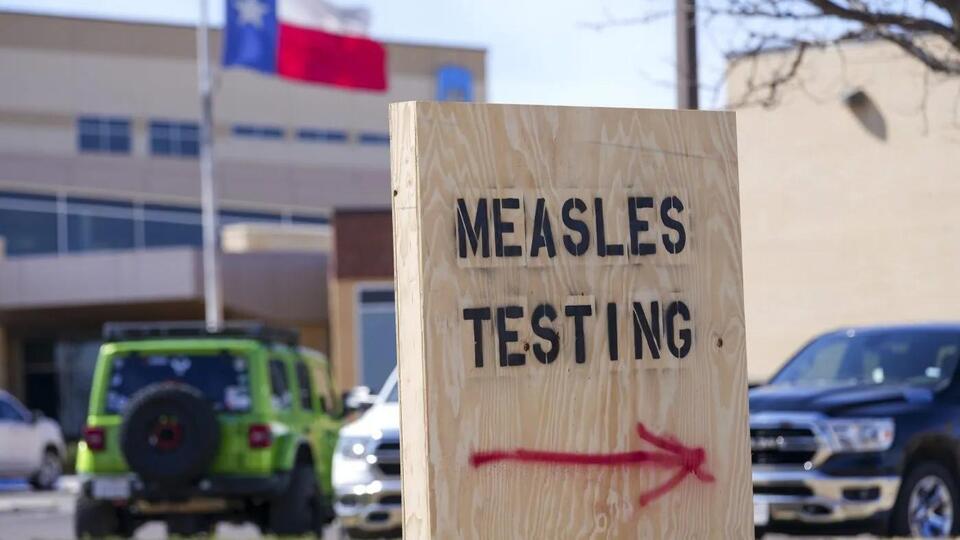 Canada’s Measles Surge: What’s Going On?