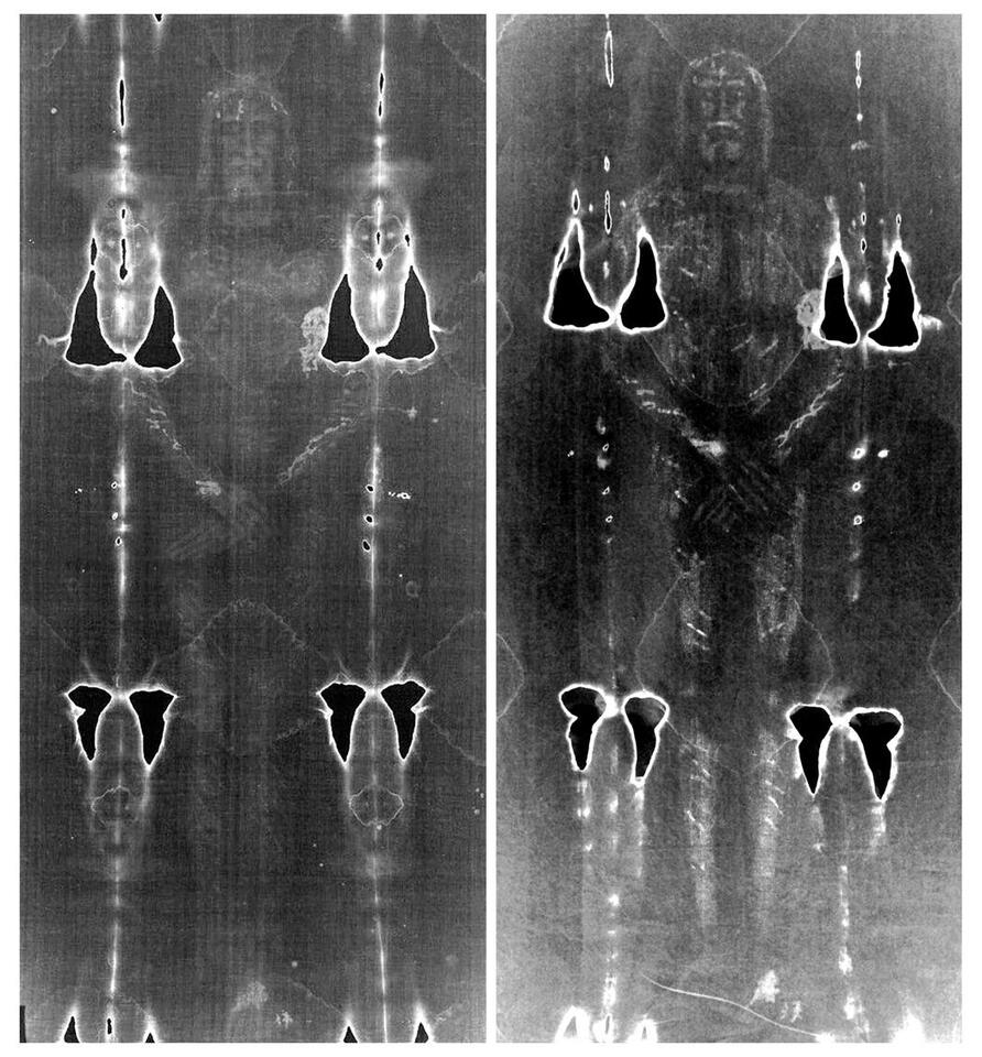 Shroud of Turin: Art or Ancient Relic?