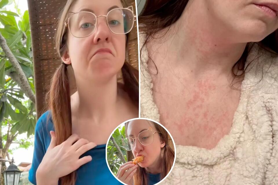She Left the US—Her Allergies Disappeared?!