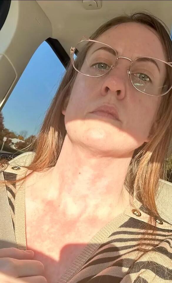 She Left the US—Her Allergies Disappeared?!