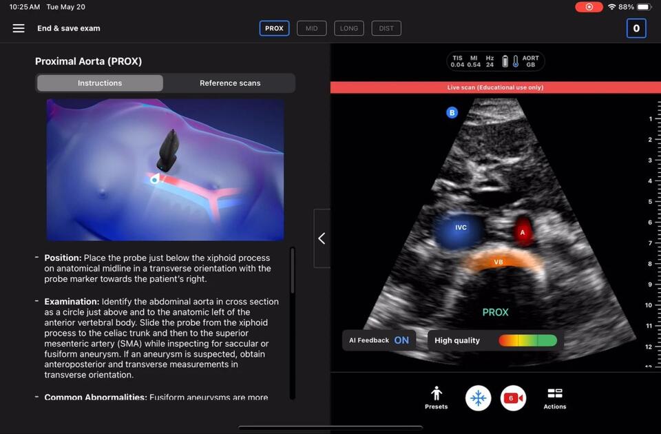 AI Ultrasound: Is Diagnosis Going DIY?