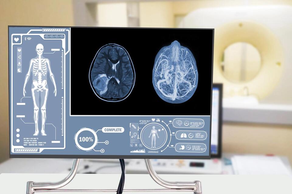 NJ Woman Crushes Brain Cancer Odds