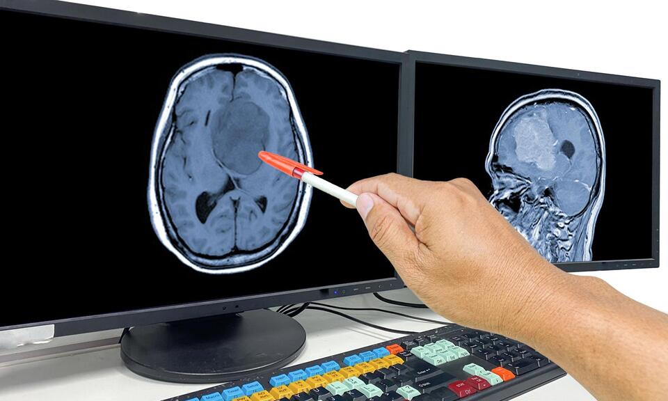 NJ Woman Crushes Brain Cancer Odds