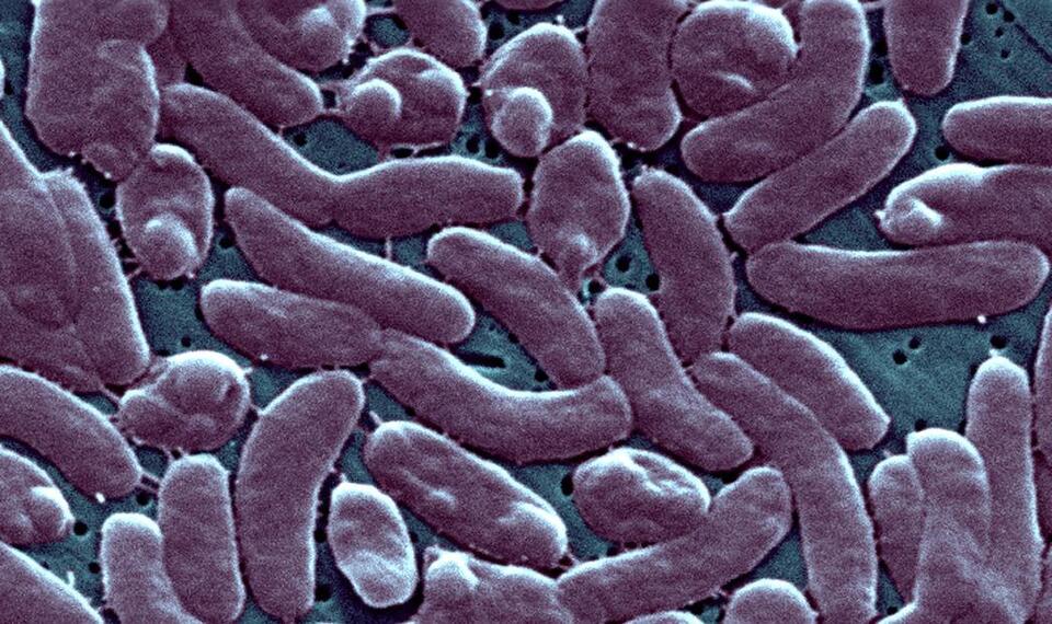 Flesh-eating bacteria on the rise in NC waters