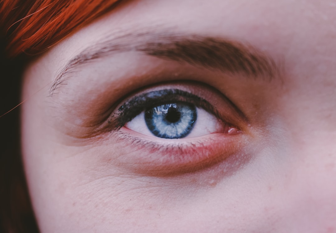Is there anything that actually helps with under-eye lines??