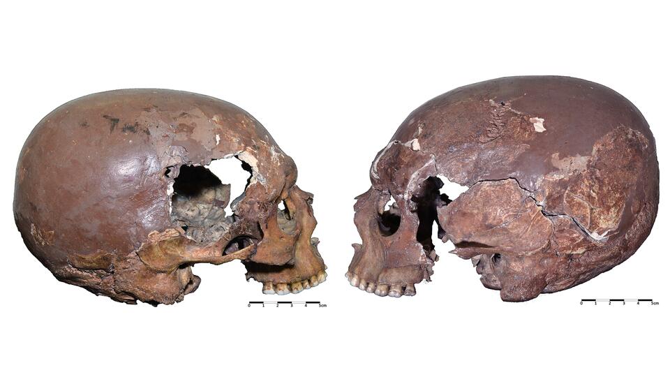 Europe’s Oldest Head-Shaping Trend?!
