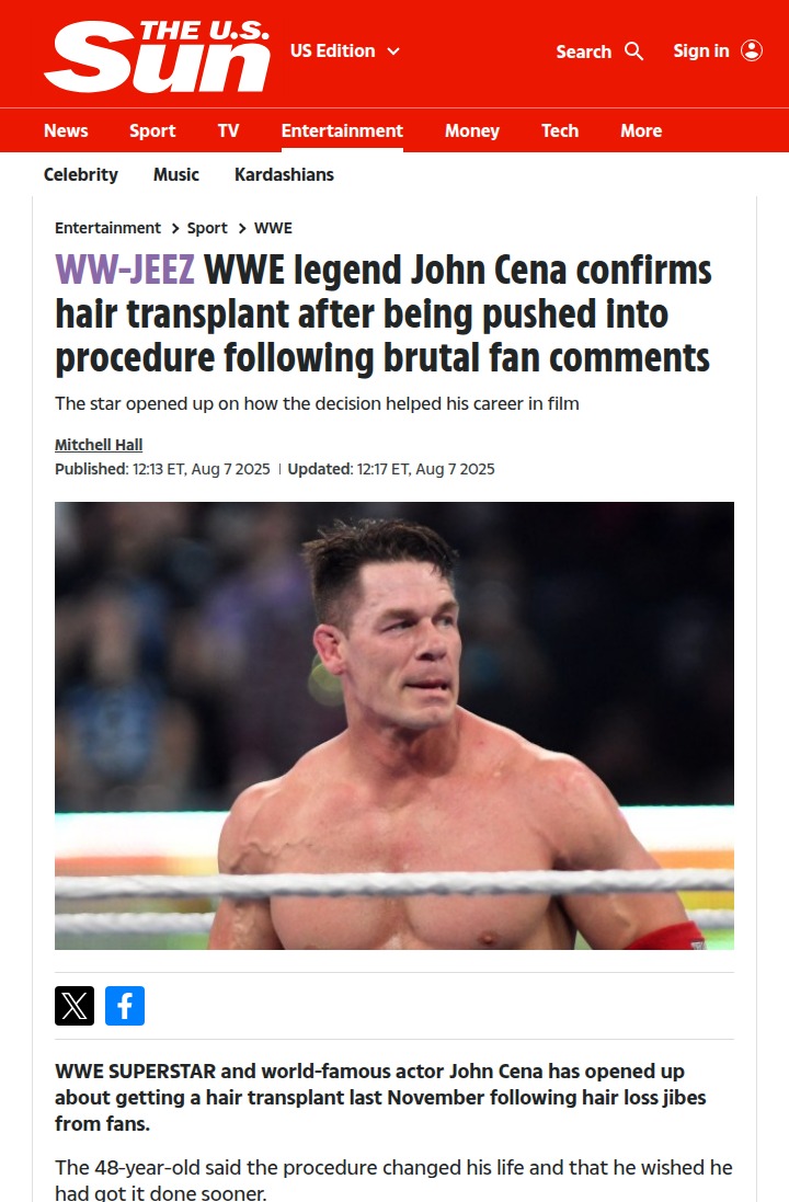 John Cena Opens Up on Hair Transplant