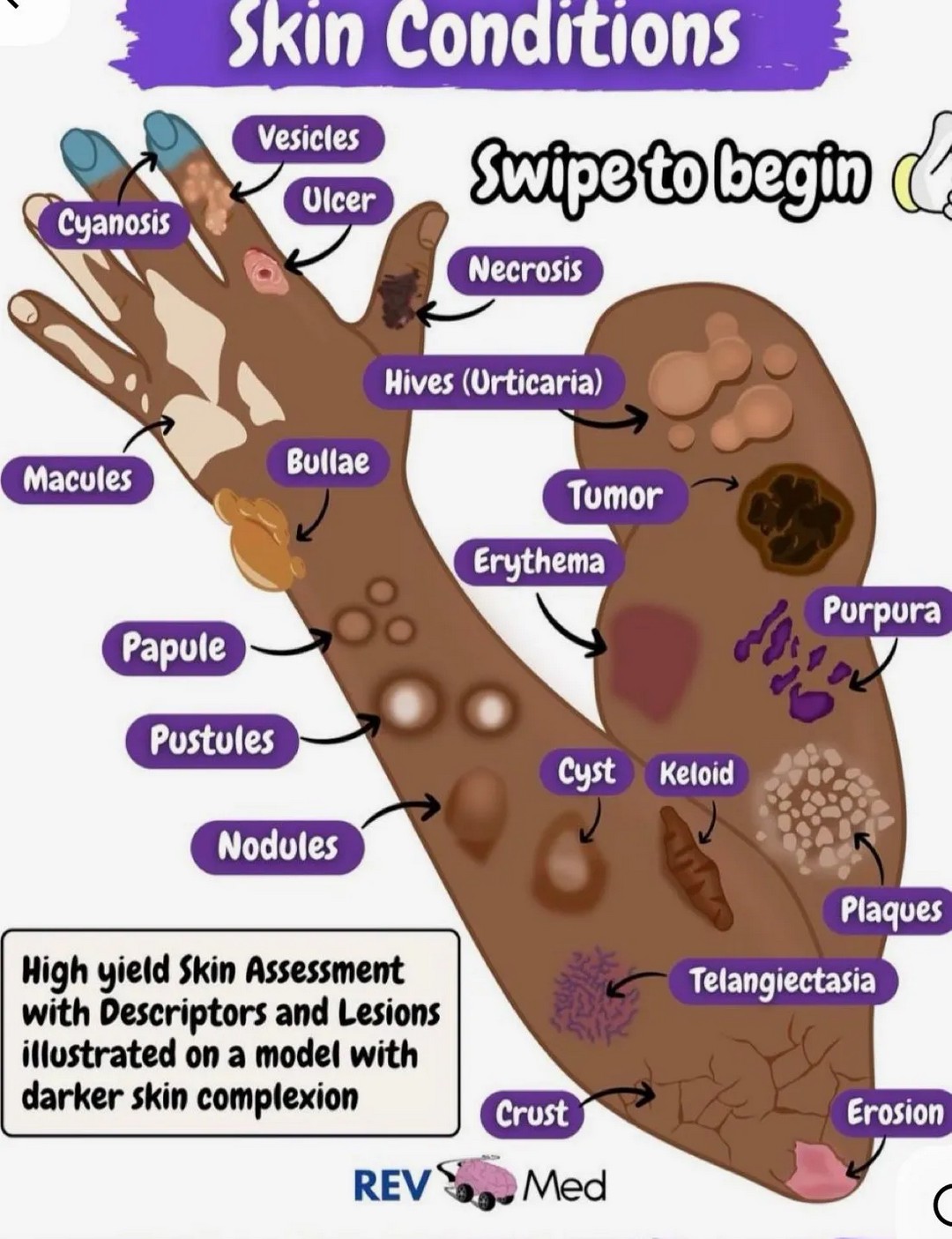 Understanding these signs and checking your skin frequently could prevent serious illness and save on medical costs