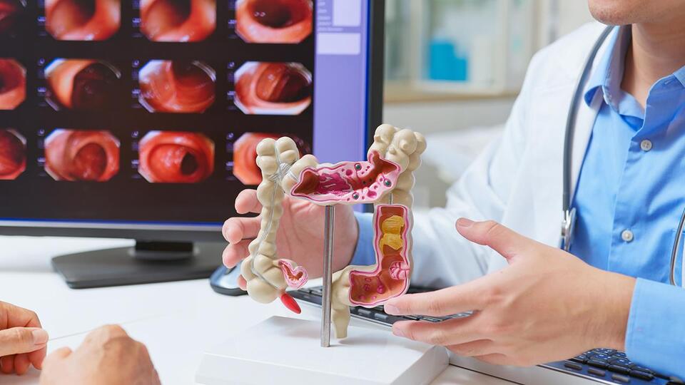 Why Colon Cancer Is Rising in Your 40s