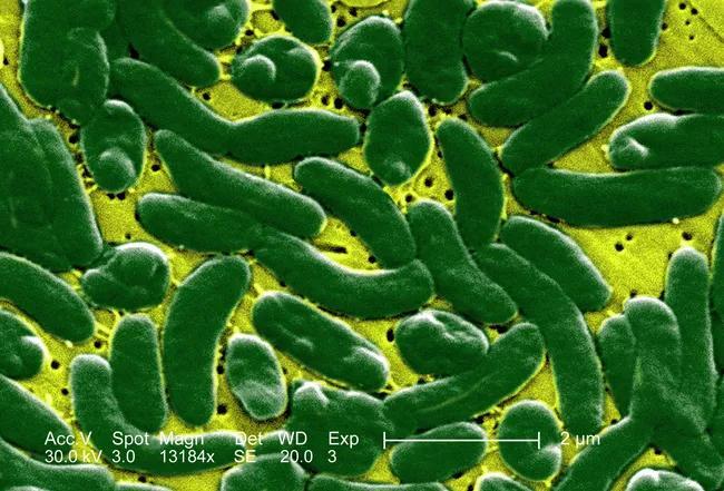 Flesh-Eating Bacteria Cases Are Climbing