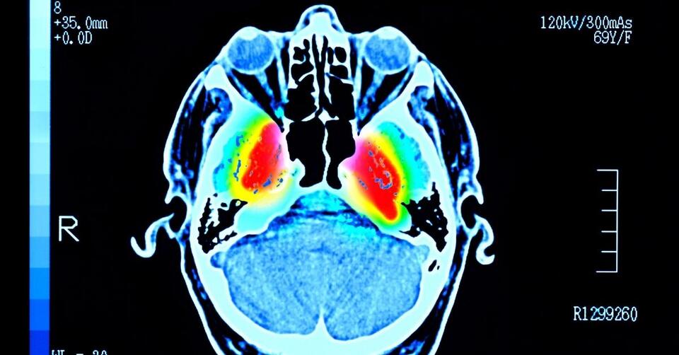 Could This Be a Game-Changer for Parkinson’s?