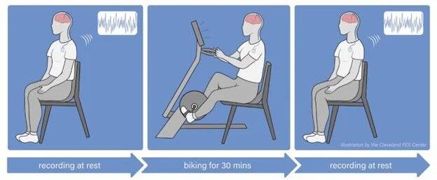 Cleveland study: Exercise may rewire Parkinson’s brain