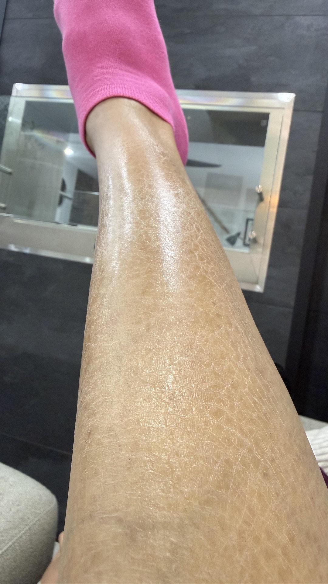The way to fix these “lizard legs”