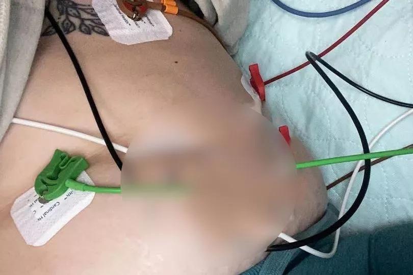 Florida mom’s scary wake-up call after vaping