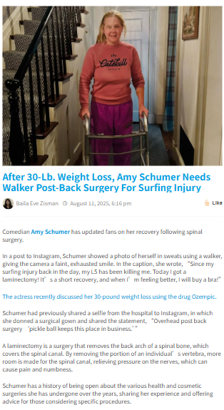 Amy Schumer’s Wild Surfing Injury Update