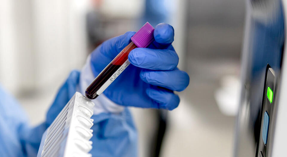 Blood Test Breakthrough for Chronic Fatigue?