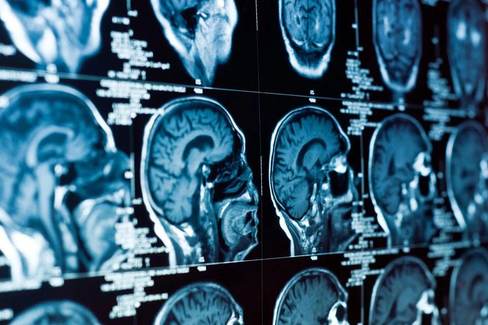 Forever Chemicals Messing With Our Brains?!