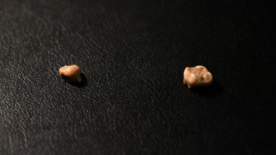 Ancient Proteins Spill Human Evolution Tea