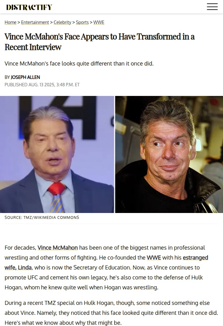 Vince Defends Hulk Amid Face Change Buzz